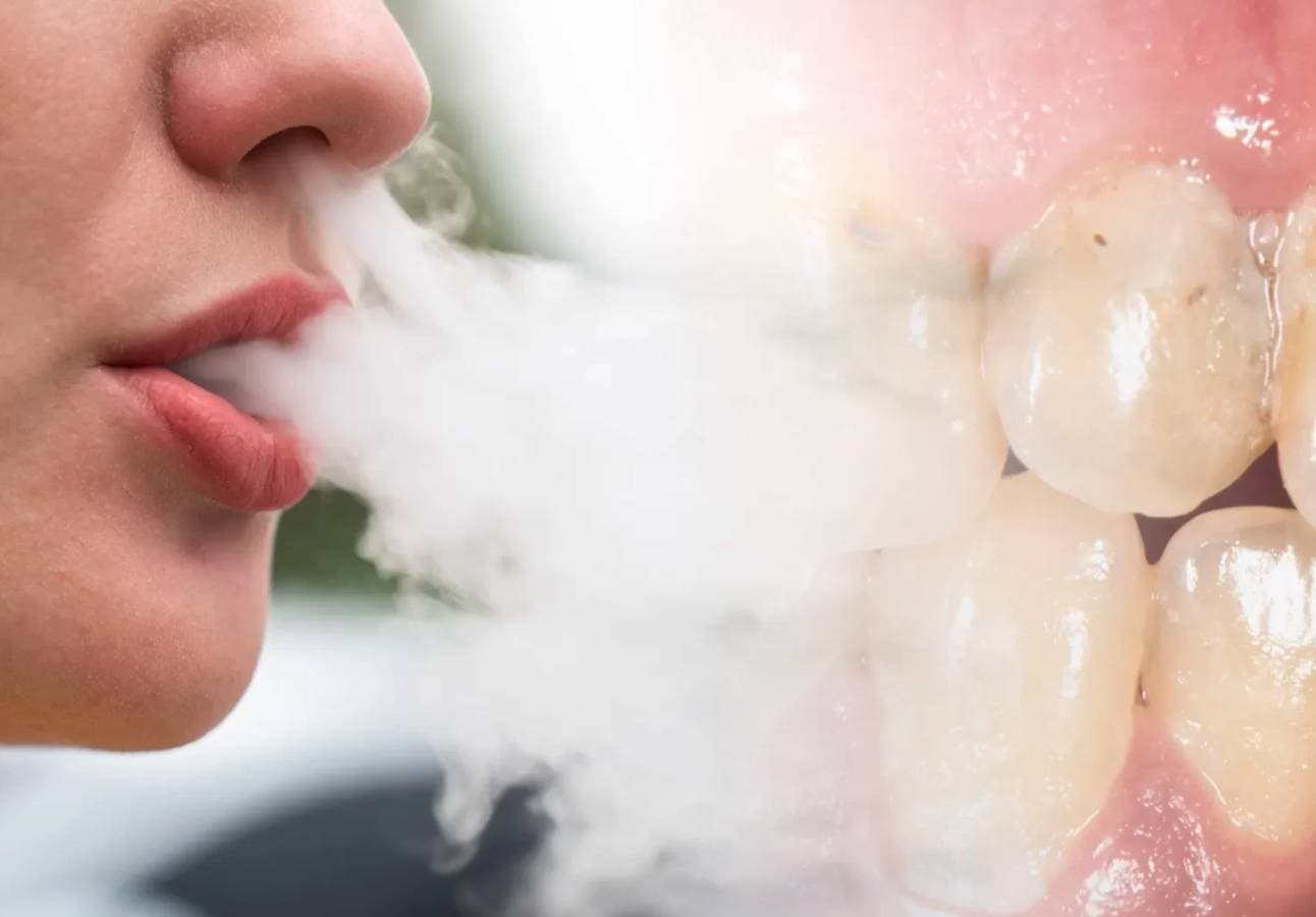 Kan tandläkare se om man röker vape? 
